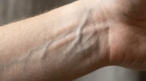 Blue veins visible on the wrist, commonly associated with a cool skin undertone.