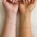 Blue vs green wrist veins showing different skin undertones