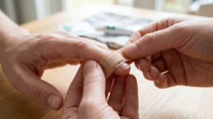 Protecting a loose fingernail with a sterile bandage
