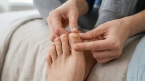 Person carefully checking a big toenail that is coming off but still attached.
