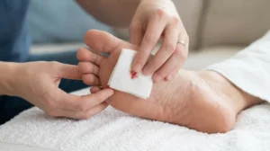 Applying steady pressure with sterile gauze to stop a cut under the toe from bleeding.