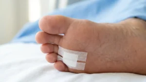 Loosely covering a cut under the toe with a sterile nonstick bandage.