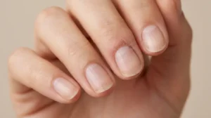 Close-up of fingernails showing subtle changes linked to a skin condition